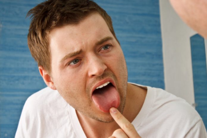 5 Effective Home Remedies to Heal A Sore Tongue